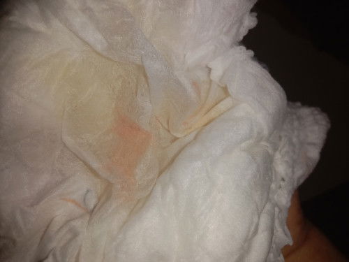 Usia anakku 8 bln 15 hari