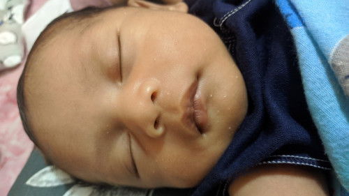 Bintik putih di wajah