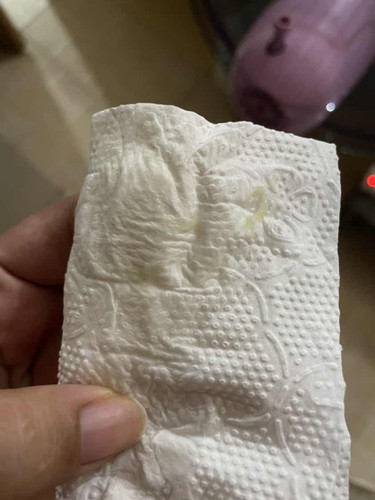 แบบนี้คือใกล้คลอดยังคะ