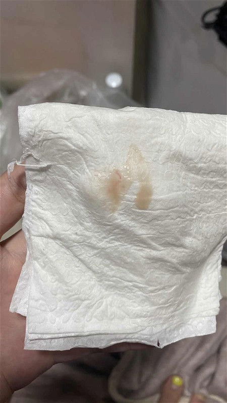 ตกขาวสีน้ำตาลอ่อน