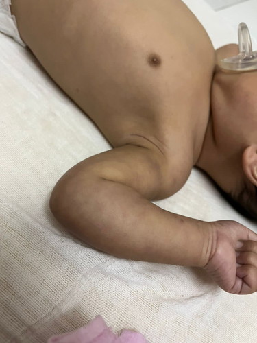 Badan bayi naik color sebam