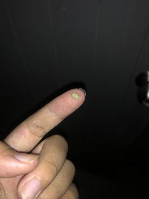 ตกขาวแบบนี้เป้นไรไหมคะ