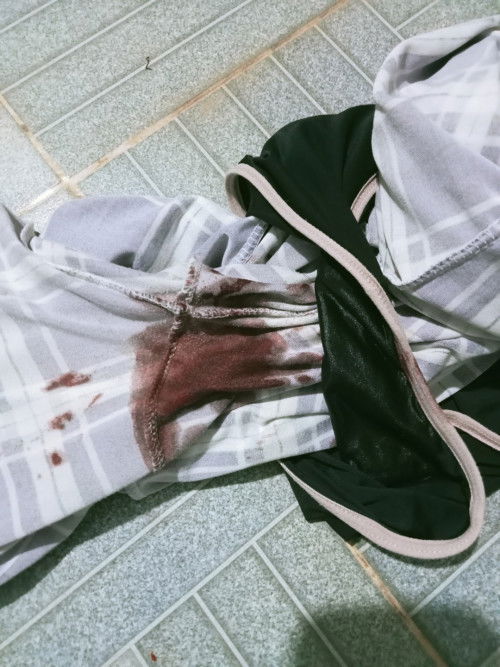 แท้งใช่ไหมคะ