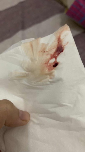 Keluar flek kedua kalinya