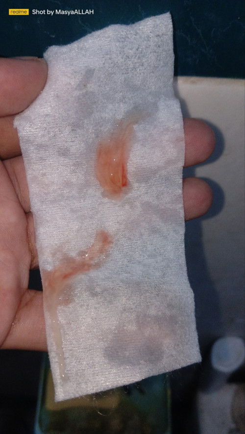 Apakah ini sumbatan lendir tanda mau melahirkan