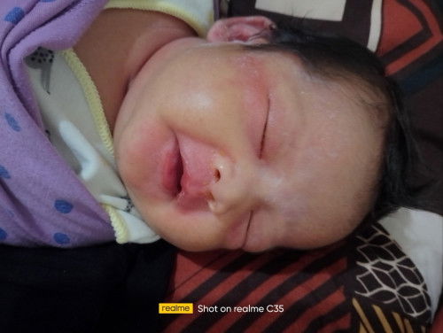 Anak saya kenapa ya Bun ????