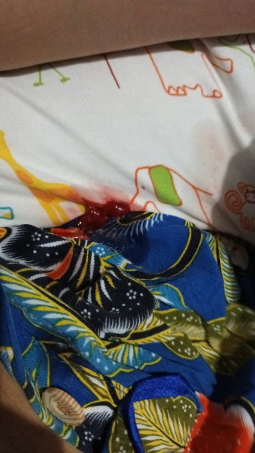 Gumoh ada gumpalan darah