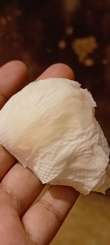 เเม่ๆแบบนี้ใกล้จะคลอดยังค่ะมีมูกออกมา