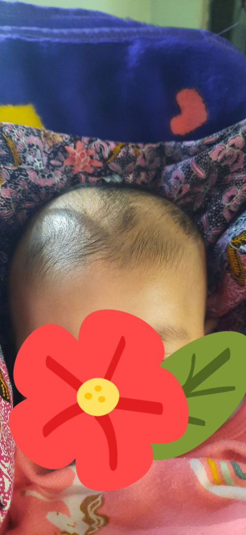 Bentuk Kepala Bayi