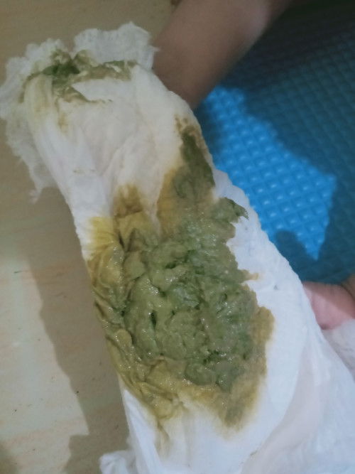 Bayi mpasi pke serelac beras merah ini masuk semvelit ga bub