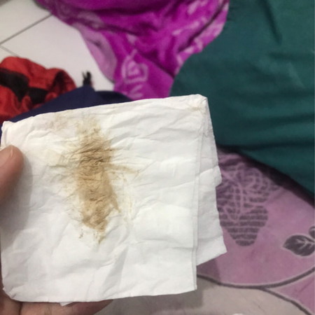 Flek coklat kehamilan 10minggu