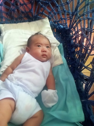 tanong lang po normal lang po kaya me na kalbo na parang poknat sa me bandang bumbunan ni baby?