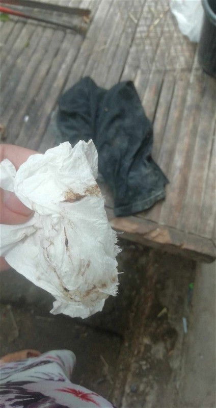 อายุครรภ์​37Week