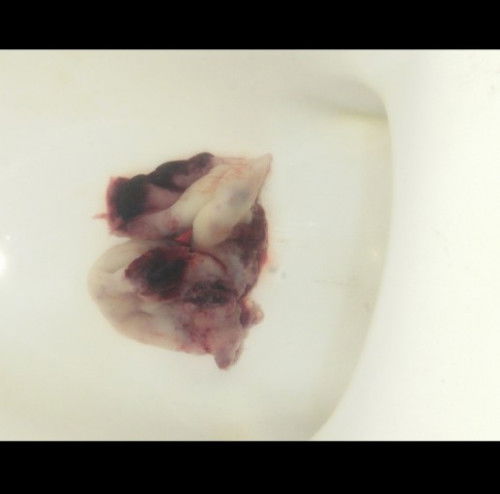 สอบถามแม่ๆ