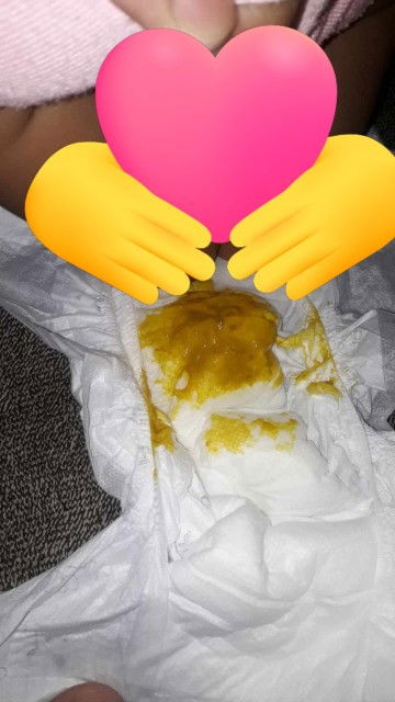 Ano pa kaya ito 3days sya bago dumume pero yung dumi nya may sipon