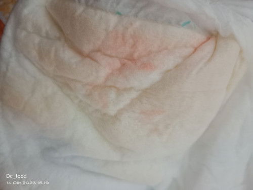 Bun ada yg mengalami juga ndk? Bercak darah d pipisny