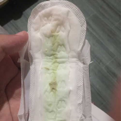 Yellow greenish discharge but no odor.