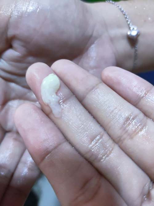 Normal Discharge or Not ?