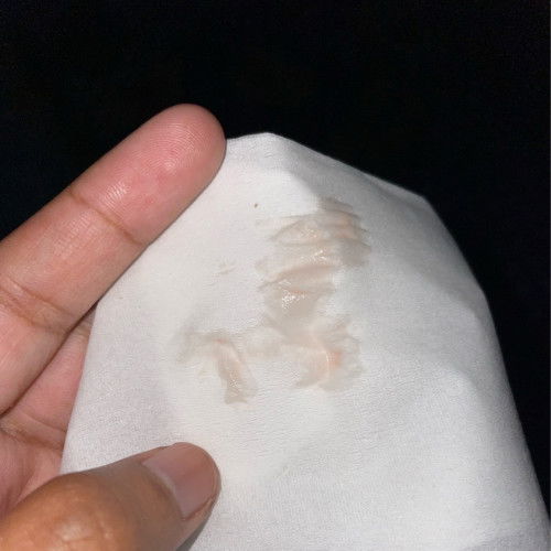 แม่ๆคนไหนมีตกขาวสีแบบนี้บ้างคะ แล้วมันปกติไหม