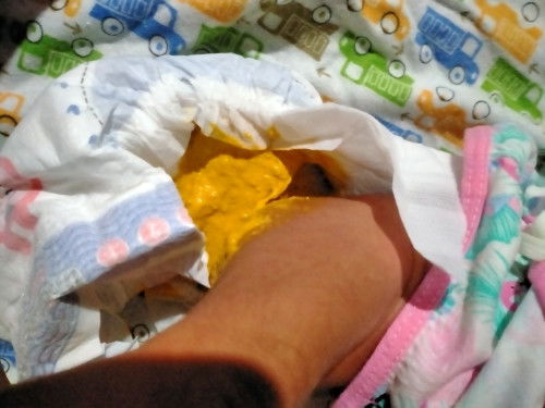 First time mom po. Okay lang po ba yung poop ni baby? Minimix feed ko po sya.