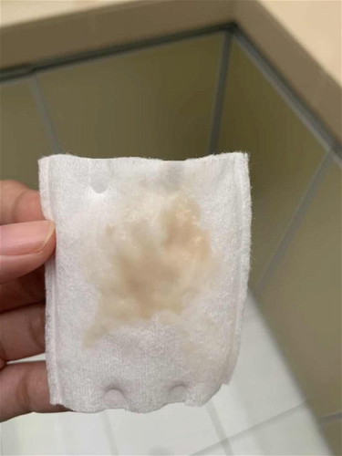 Adakah ini normal