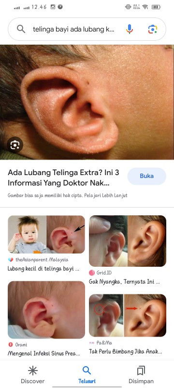 Lubang di telinga seperti bekas tindikan