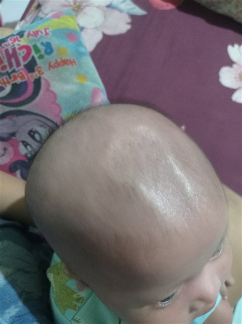 Bentuk kepala bayi 2 bulan