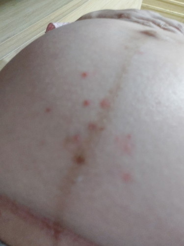 Nóng khi mang bầu