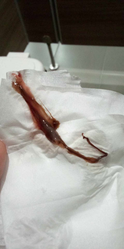 สอบถามแม่ๆหน่อยค่ะ