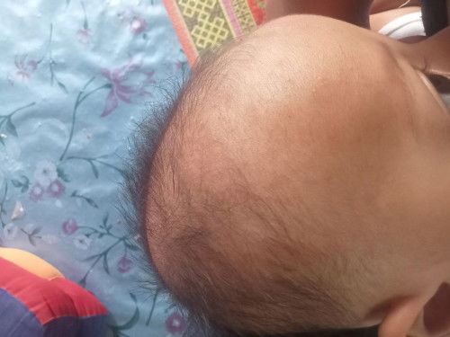 เป็นผื่นใช้อะไรทาได้บ้างคะ