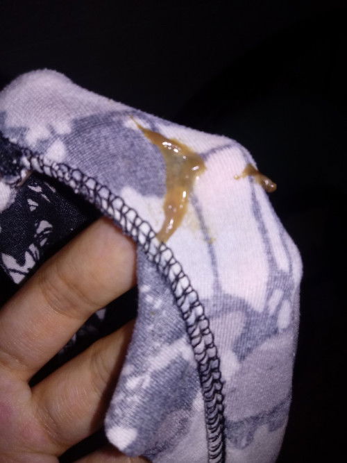 Mucus plug or discharge ?