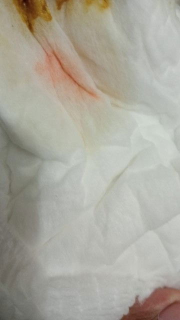 Bunda2 mau tanya dong bayiku 5bln 28 hari worry gak sih ...!!!