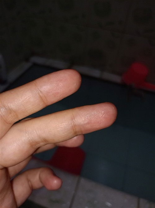 Hamil 39w kontpal & keluar lendir