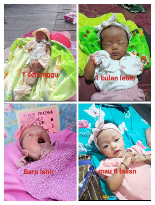 Perubahan kulit anak