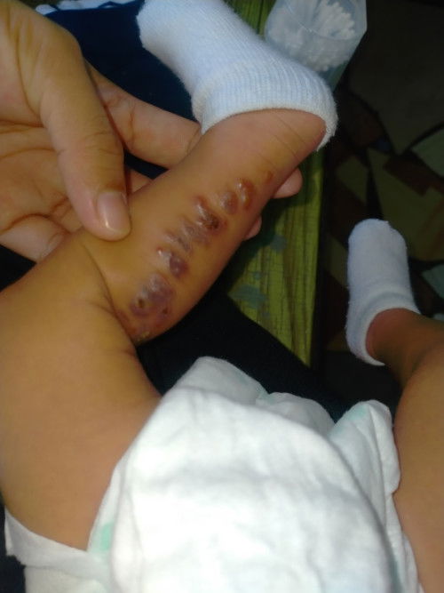 any ideas po kung ano ba talaga ito mag 1 month pa lng si baby.