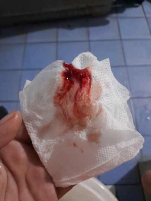 กระตุ้นปากมดลูก