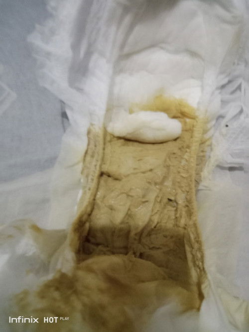 Pa help nman po mga mhie first time mom po ako