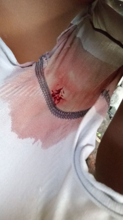 Mau nanya Bun ada yg sama gak ?