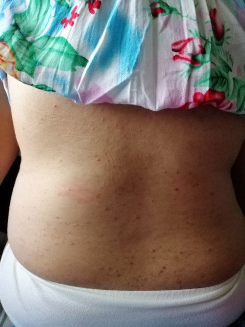 Nangangati buong latawan