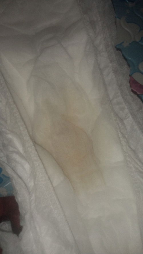 Warna pipis bayi 5 bulan apakah normal?