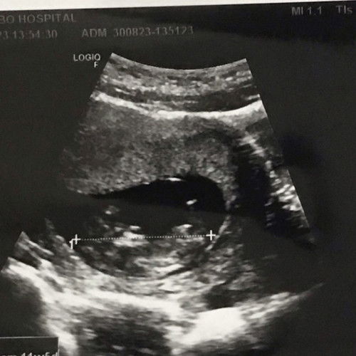 ยังไม่รู้เพศเลย