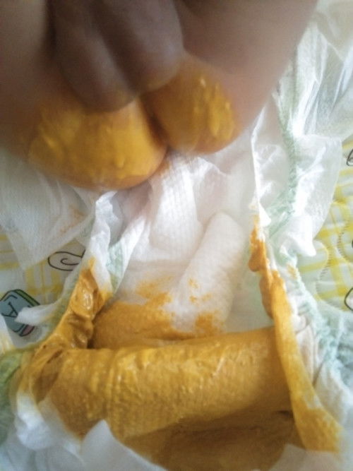 normal po ba poop ni baby