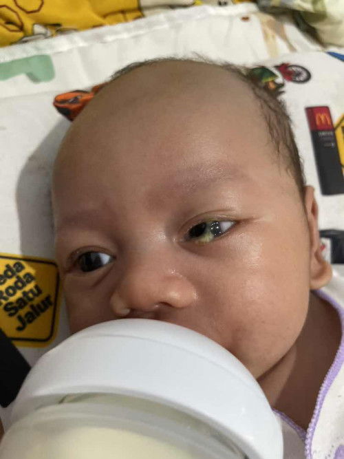 mata bayi belekan