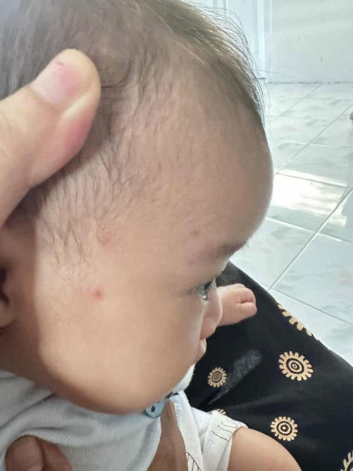 Kira kira ini kenapa ya bund