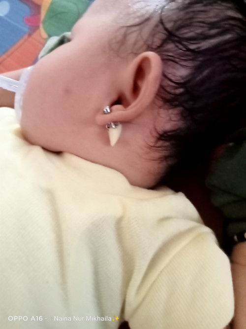 Bunda anak saya baru pasang tindik,,antingnya model stud gitu tapi pasaknya tajam bngt
