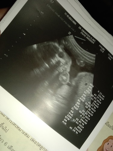 หมอบอกหัวลูกอยู่ด้านล่าง