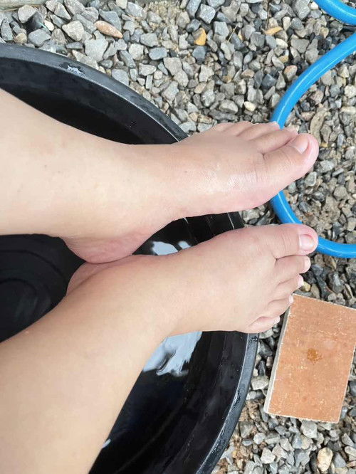 เท้าบวม2วันแล้วค่ะ