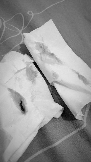 Keluar darah UK. 8Minggu 5 Hari