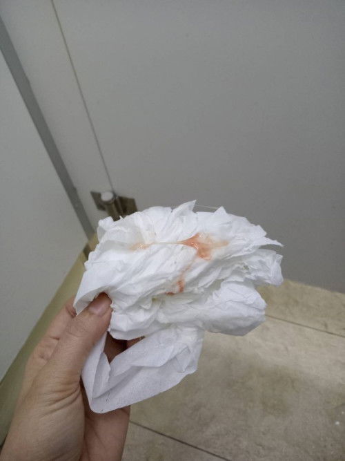 ครรภ์ได้7สัปดาห์