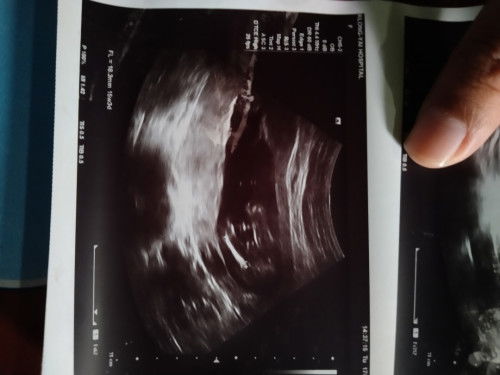 จู๋ใช่ไหมคะ